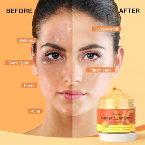 Turmeric Vitamin C Clay Mask| Deep Cleansing Facial Clay Mask for Dark Spots, Dull Skin, Refining Pores and Controlling Oil,Dark Spot Remover for Face,Face Masks Skincare-Gift for Him & Her