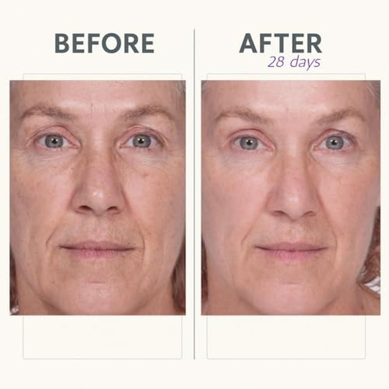 Reverse Lift Firming Facial Serum, Visibly Firm, Tone & Tighten Skin, Hydrating Anti-Aging Peptides, Reduce Wrinkles, Sagging Face and Neck, Serious Skincare, 1 oz