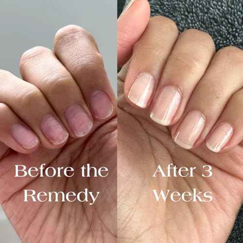 Botanist The Remedy | Nail Strengthening Polish | Repairs & Hardens Nails Damaged from Acrylics, Dip & Gel Manicures | Non-Toxic, 84% Plant Based, 21-Free & Vegan (Nude)