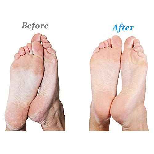 Emjoi Micro-Pedi Ultra Callus Remover (Pink)