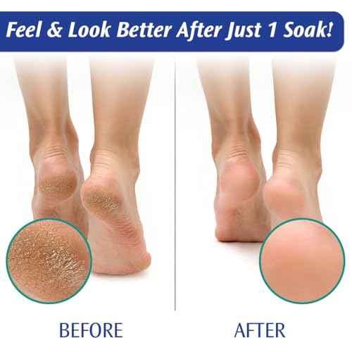 PediFix Soaking Crystals Foot Bath ? 6 Packets ? Therapeutic Foot Soak with Tea Tree Oil & Epsom Salt for Sore, Tired, Achy Feet