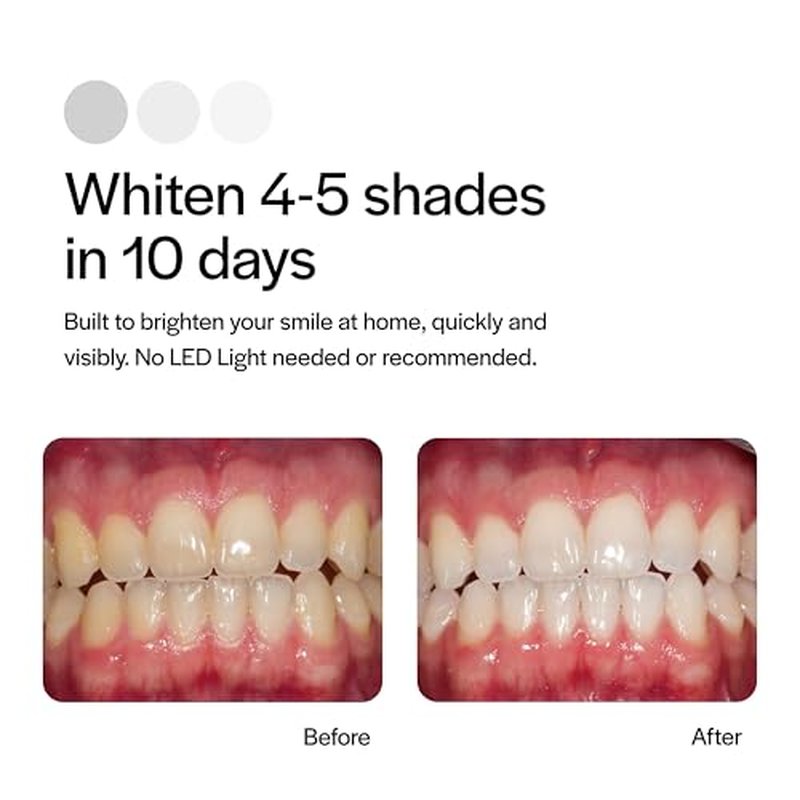 Opalescence Go - Prefilled Teeth Whitening Trays - Original 15% - (4 Treatments) - Hydrogen Peroxide with PF - Cool Mint - Made by Ultradent. 4648-1