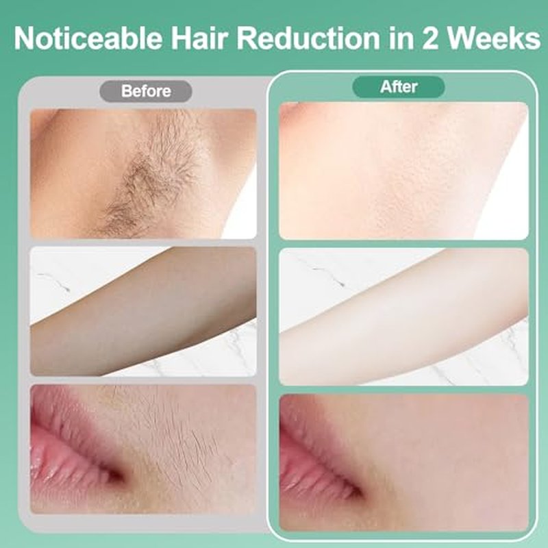 Sapphire Ice Cooling Hair Remove Device, Ice-cooling Device Hair Removal for Nearly Painless, Auto Flashing for Fast Full Body Hair Removal, White