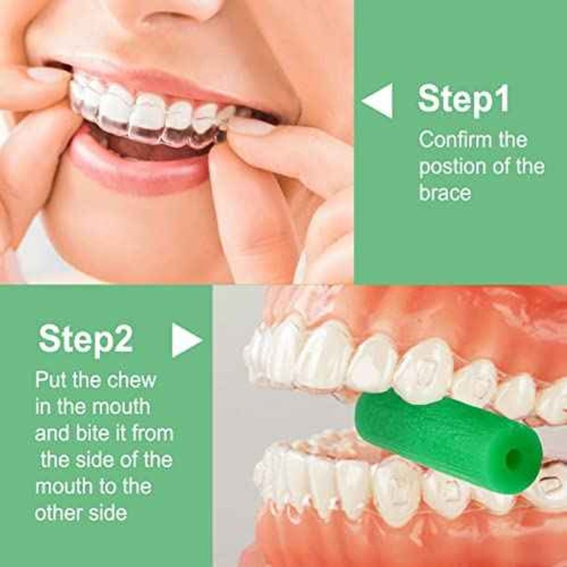 BVN Aligner Chewies, 10 Pieces Orthodontic Chewies, Retainer Chewies, Dental Chewies for Aligners, Orthodontic Dental Chewies Munchies, Green