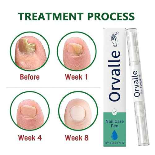 Orvalle Nail Fungus Pen, Nail Growth Treatment Repair Serum Twist Pen Activator for Repair & Strengthener(2PCS)