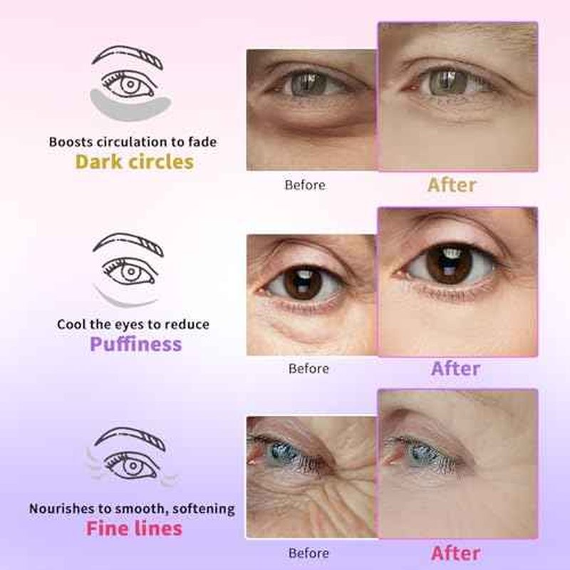Under Eye Patches for Dark Circles, Puffiness, Fine Lines, Eye Mask Set with Retinol, 24K Gold, Caffeine, Gel Mask for Birthday & Spa Party Favors, Skincare Gift for Women & Men, 24 Pairs