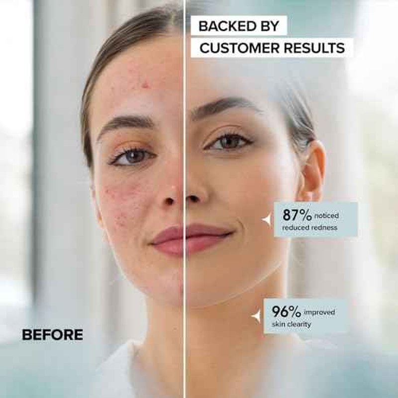 Face Towels - Ultra Soft and Thick Disposable Face Towelettes for Women - Biodegradable Facial Towels for Sensitive Skin - Face Cleansing, Makeup Removal, 10x12 Extra Large - 50 Pack