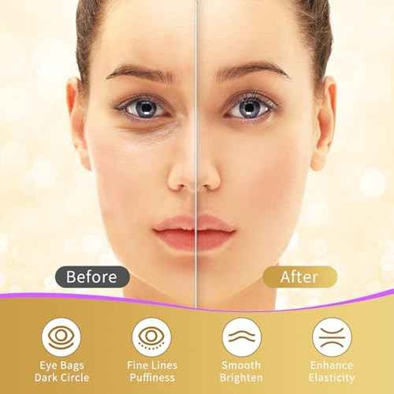 Under Eye Patches, 40 Pairs Eye Mask for Dark Circles, Puffy Eyes, Undereye Bags,Wrinkles,Eye Mask Patches with 24K Gold, Eye Treatment Skin Care for Men & Women Gift