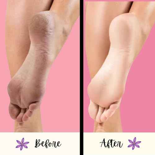 Mr. Pumice Purple PUMI Bar - Extra-Coarse, Pumice Stone for Feet Callus Remover, Pedicure Tools for Feet, Foot Scrubber for Dead Skin Remover, Foot Care, 4 Pack