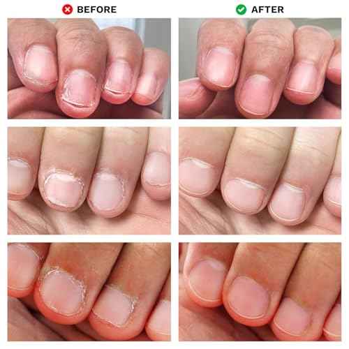 Nails Spray Fast-Drying Nail Care Moisturizer with No Odor Formula for Men & Women, Safe Mild Ingredients, 30ml/1fl oz