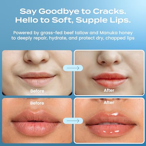 Body Restore Grass Fed Beef Tallow Lip Mask, Manuka Honey ? Christmas Stocking Stuffers, White Elephant, Hydrating Moisture, Travel Essentials, Self Care, Birthday Gifts for Women, Men ? Peppermint