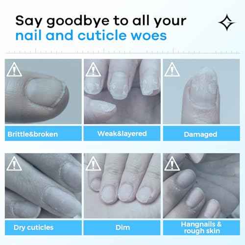 Hard Nail Strengthening Cream: Nail Strengthener and Cuticle Treatment to Repair &grow Split, Thin, Peeling Nails and Dry, Cracked Skin, Plant-Based Scent, 1 oz,Essential Manicure Nail Care