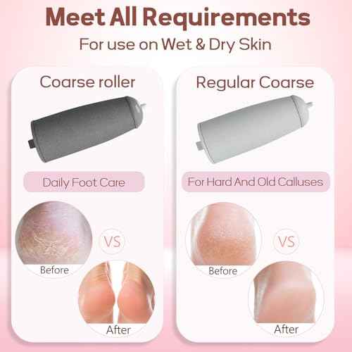 Callus Remover for Feet, ZABOUL Electric Foot Callus Remover Rechargeable Pedicure Tools Smooth Pedicure Wand Electronic Foot File, Feet Care for Removes Dry Hard & Dead Skin Ideal Gift