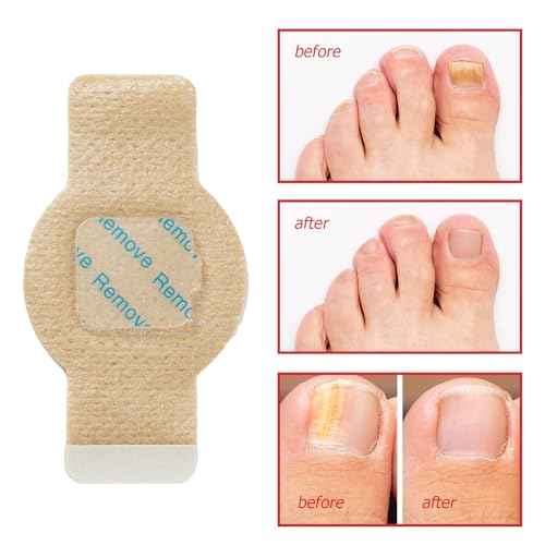 Nail Patches for 8-Hour Overnight Fast Hydrogel Nail Care, Keeps Feet Fresh & Dry All Day ? Men & Women (2)