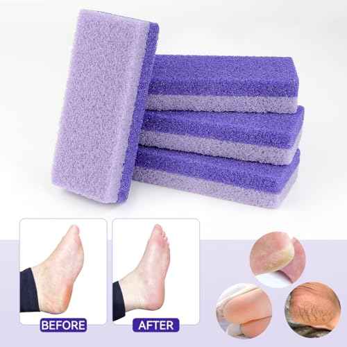 4 Pcs Foot Pumice Stone and Scrubber for Feet and Heels Callus and Dead Skins (Purple)