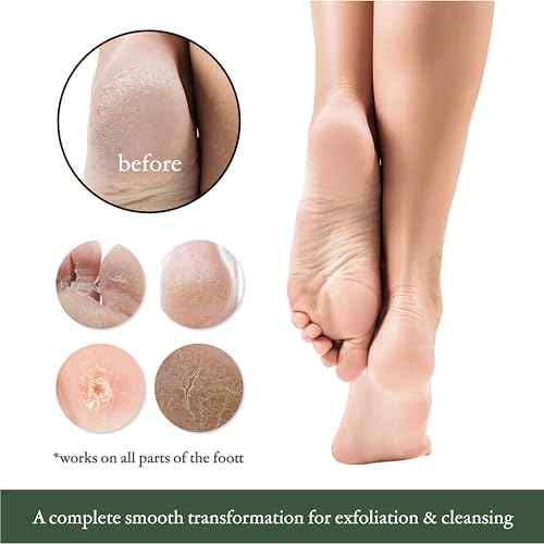 TADA Natural Beauty ADA Natural Beauty Pumice Stone for Feet with Bamboo Handle - Foot Scrubber and Callus Remover for Feet (Black)