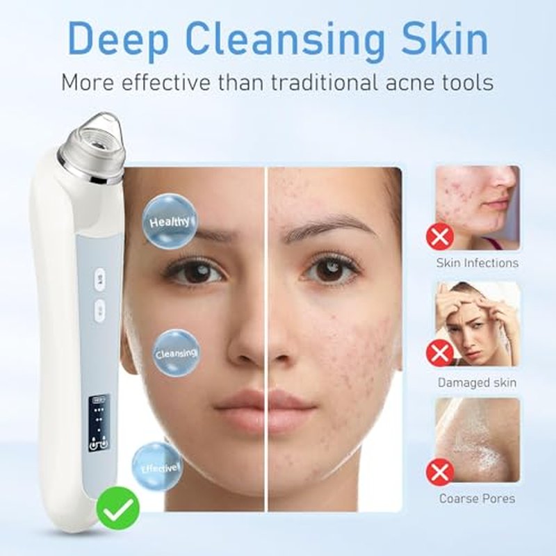 Facial Pore Blackhead Remover Vacuum, 1080P Camera Blackhead Remover, 20x Zoom, 8 LEDs £¦ 3 Suction Modes, 800mAh Battery & USB - 6 Heads Pore Cleaner Kit for Women&Men(White)