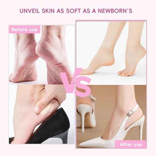 Electric Foot Callus Remover,Professional Foot Glass Sanding Machine with 9 Speed Settings, Type-C Charging, 3 Replaceable Rollers, Pedicure Tools with 30 Sandpaper Discs for Dead Skin-Black