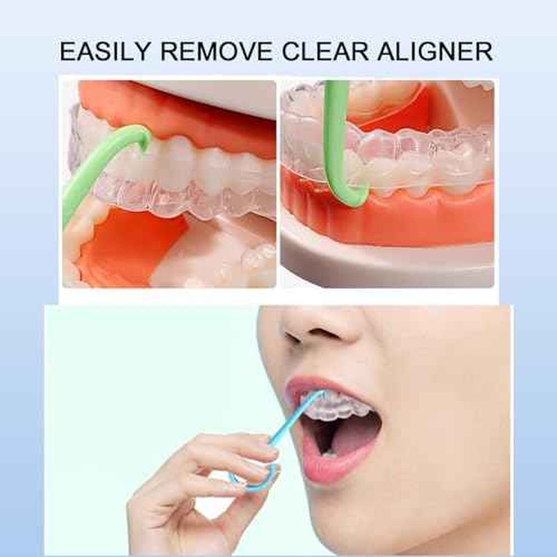 5PCS Aligner Removal Tool,Black Clear Aligner RemoverTools for Invisalign Removable Retainers, Aligners,Braces Removal Kit (5PCS Black)