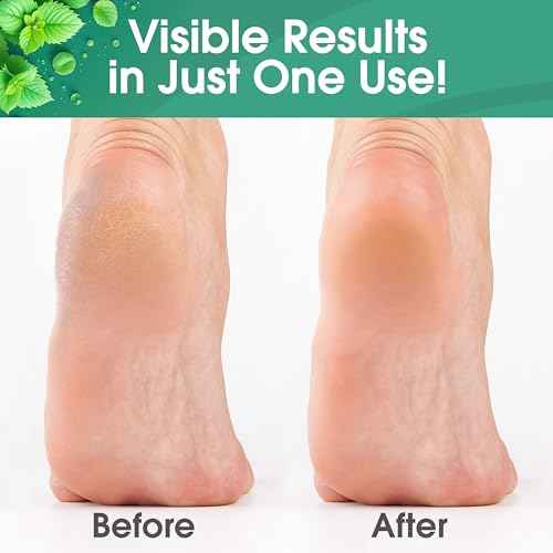 Callus Remover for Feet, Extra Strength Foot Callus Remover Gel, 128oz Gallon Salon Grade Bulk Pedicure Supplies for Dry Skin, Cracked Heel, Professional Strength Foot Care, Cool Mint
