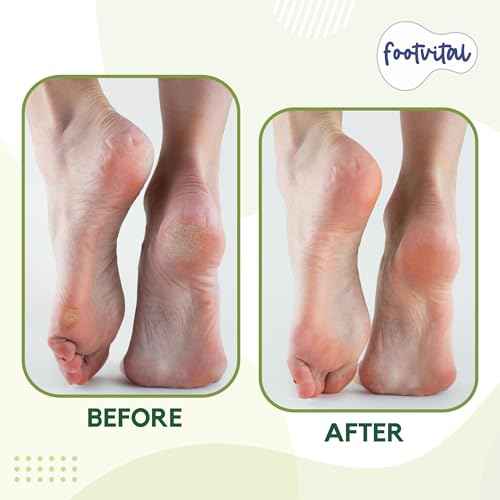 Pumice Stone for Feet, Foot Exfoliator Scrubber, Callus Remover, Made of Natural Terra-Cotta, Exfoliates & Smooths Rough Skin