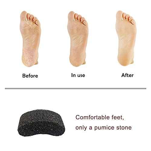 Natural Lava Pumice Stone, Pedicure Tool, Hard Callus Dead Skin Remover, Foot File for Exfoliation & Fine Foot Scrubber for Smoothing & Softening Skin¡¦