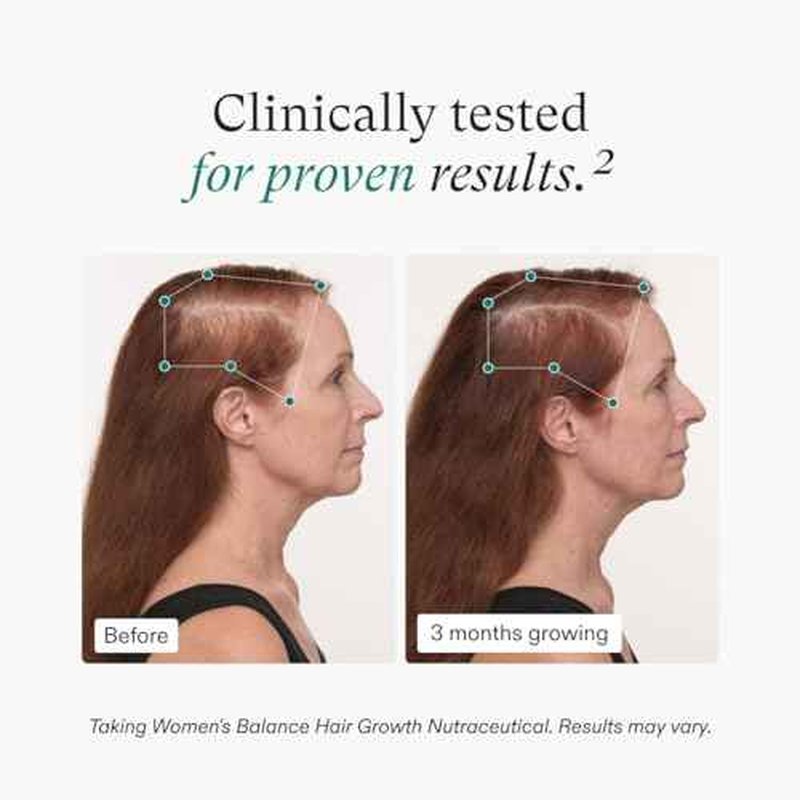 Nutrafol Women's Balance Hair Growth Supplement with Collagen Peptides, Ages 45+, Clinically Tested for Stronger, Visibly Thicker Hair, Dermatologist Recommended - 1 Month Supply, 12 oz Bottle