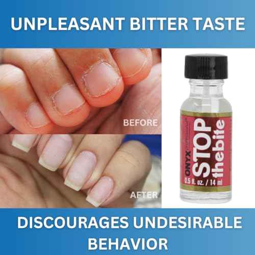 Onyx Professional Stop the Bite Nail Biting Prevention Polish, 0.5 Fl Oz - Made in USA, Stop Nail Biting, No Bite Nail Polish, Thumb Sucking Deterrent
