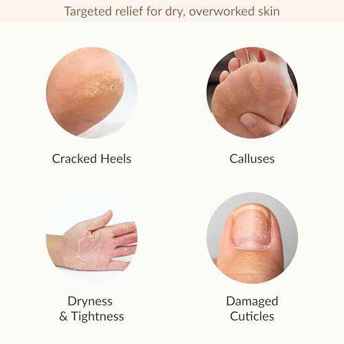 Epielle Hydrating & Moisturizing Hand & Foot Masks for Dry, Rough Skin, Self Care Gifts for Women, Spa Kit, Stocking Stuffers, Thanksgiving Essentials, 6 Moisturizing Gloves & 6 Moisturizing Socks