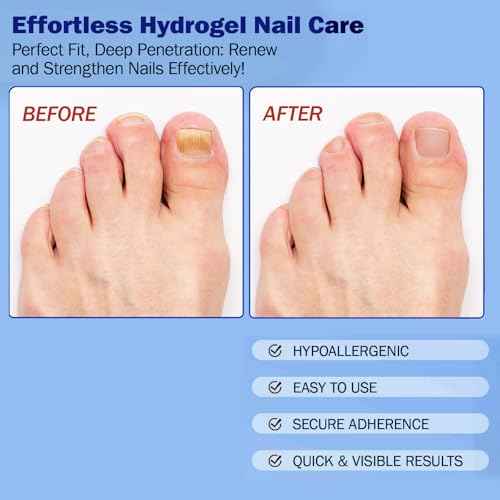Fungal Nail Patches for Toenails, 21 Count - Nail Repair Patches with 8-Hour Adhesion, for Discolored & Damaged Toenails Care, Overnight Renewal for Men & Women