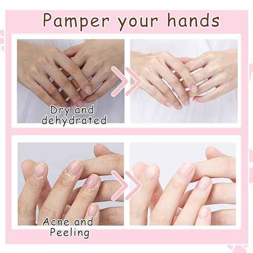 Hand Masks, 6 Pairs Hydrating Exfoliating Hand Peeling Mask, Smooth Hand Masks Moisturizing Gloves Overnight for Dry, Rough, Cracked Hands, Hand Skin Moisturizer Glove for Women Men£¨A