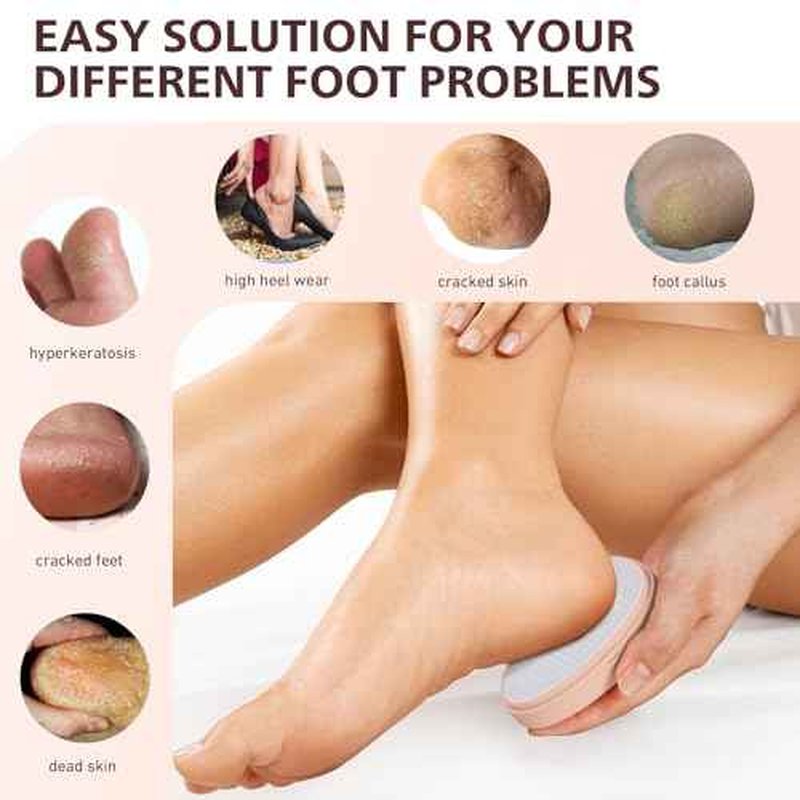 BALUCA Glass Foot File Callus Remover for Feet - Nano Glass Foot Scraper Scrubber Dead Skin Removal for Cracked Heels,Professional Pedicure Tool for Home, Salon, and Travel (Apricot)