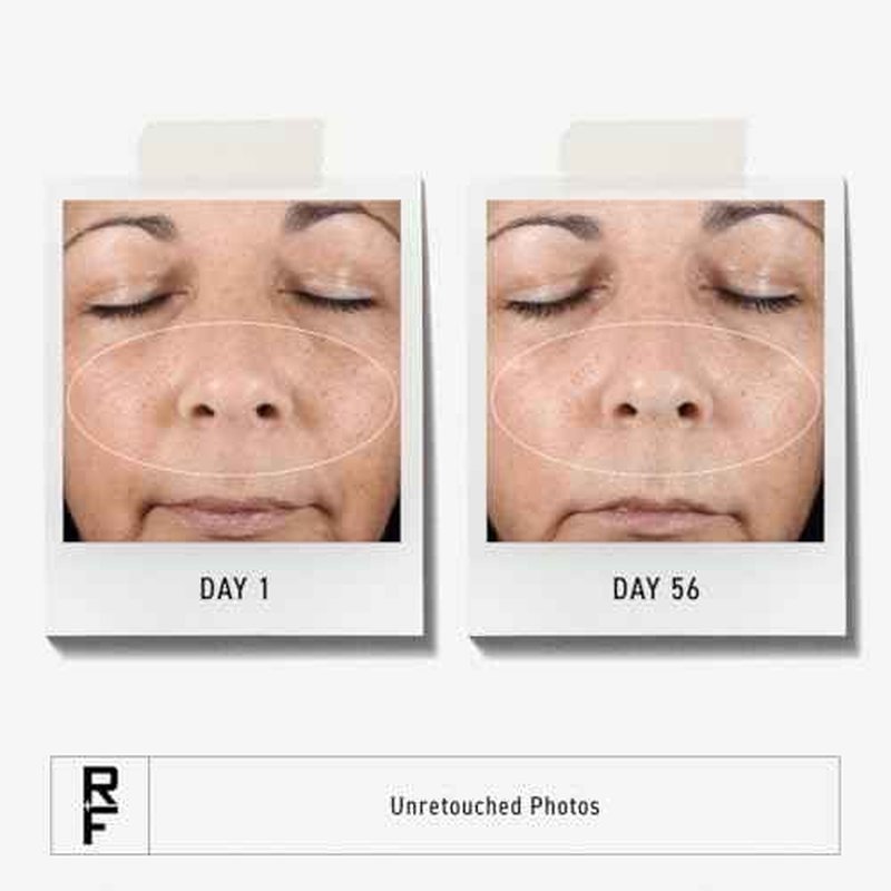 Rodan + Fields Active Hydration Serum | 1oz | Boosts Hydration Levels | Glycerin | Hylauronic Acid