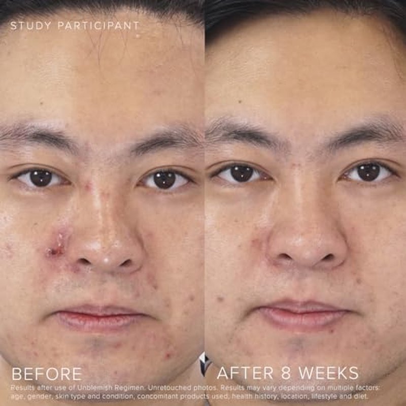 Rodan + Fields UNBLEMISH Invisible Matte Defense Broad Spectrum SPF 30 | Skincare Moisturizer | UV Skin Protection | Sunscreen Face and Neck Cream
