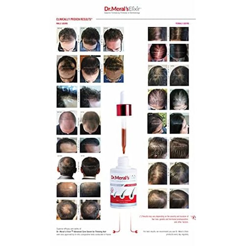 Dr. Meral's Elixir - Essential Hair Growth Products Kit: Minoxidil Free Thinning Hair Serum with Saw Palmetto & Sodium Lauryl Sulfate Free Shampoo for Hair Loss - DHT Blocker, Stimulates Hair Regrowth