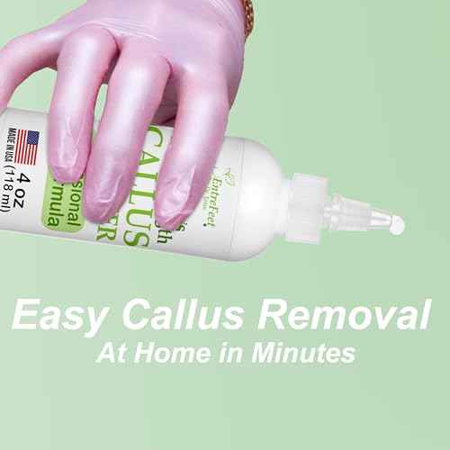 Dr. Entre's Callus Remover Gel: Extra Strength Callus Remover for Feet, Foot Callus Remover, Foot Care, Pedicure Tools Supplies, Dead Skin Remover, 4 oz