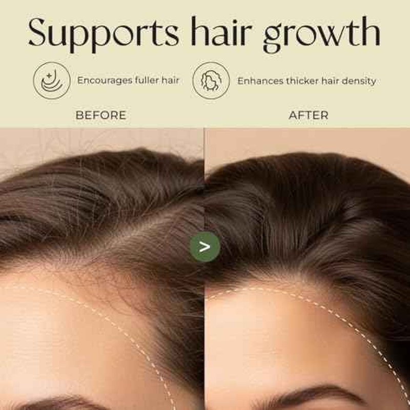 Gya Labs Rosemary & Castor Hair Oil - 4 Fl Oz - for Scalp Health, Strengthens & Protection from Damage