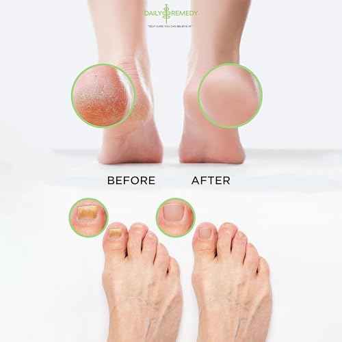 DAILY REMEDY Foot Soak Salts- Variety Pack of 4- Tea Tree Oil, Muscle Relief, Calming Lavender & Citrus Soak- For Foot Pain, Soreness, Athlete¡¯s Foot, Odors, Calluses-Made In USA