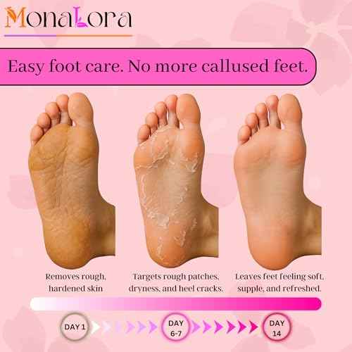 Foot Peel Mask for Dry, Cracked Heels ? Exfoliating Callus Remover with Natural Fruit Extracts ? Baby Soft Feet in 1 Week ? 2 Packs | Strawberry Scent