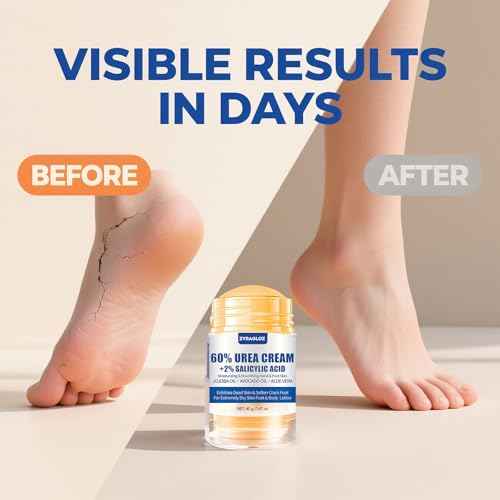 Urea Cream Stick 60% plus Salicylic Acid 2%, Maximum Strength Urea Foot Cream for Dry Cracked Heels, Feet Callus Remover, Hands Knees Exfoliating Dead Skin, Softening Skin Moisturizer Lotion