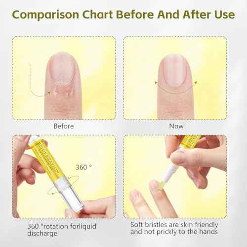 Rejuvenation Nail Growth Oil, Nail Oil for Growth and Strength Rejuvenation, Rejuvenation Nail Growth Serum for Nail Strengthener and Growth with Nails File (4PCS)