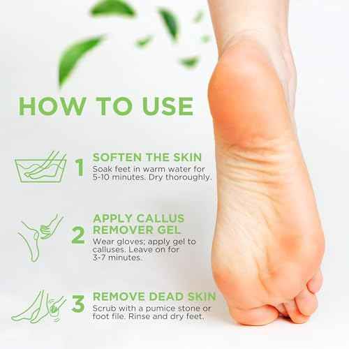Callus Remover Gel ? Professional Foot Callus Removal for Smooth Feet & Cracked Heels ? Extra Strength Callus Gel with Pumice Stone ? 8oz, Made in USA