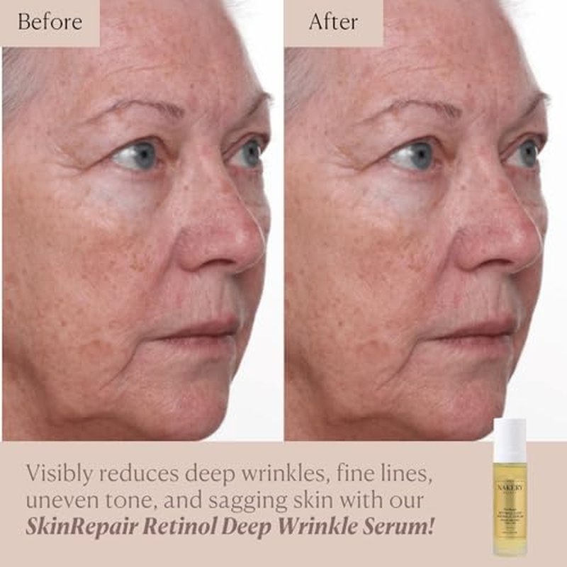 Nakery SkinRepair Retinol Deep Wrinkle Serum (2.02 Fl Oz), Anti Aging Face Serum with Encapsulated Retinol, NAD+ Complex, Ceramide NP, Hydrating Firming Skin Treatment for Fine Lines