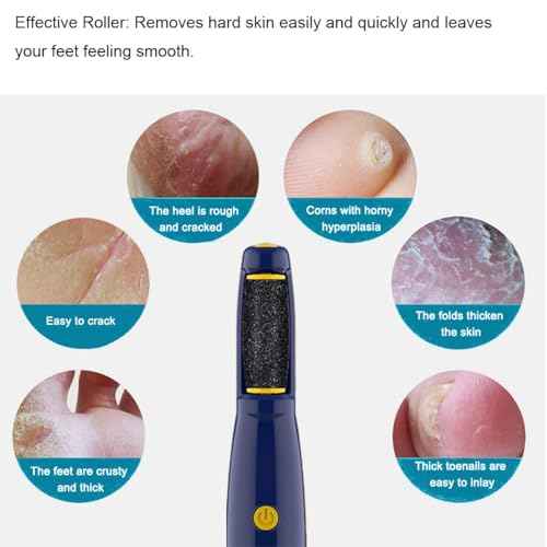 Replacement Roller Compatible with Dr. Scholl's Callus Remover Electronic Foot File-Extra Coarse (6 Pack)