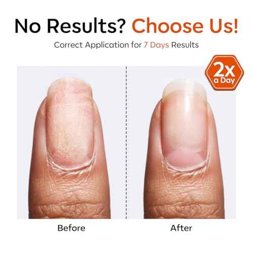 modelones Nail Strengthener and Growth Scented Nail Repair for Damaged Nails 3-in-1 Nail Hardener Extra Strong and Growth Repair Mode Gifts for Women 13.5ml 0.46 Fl Oz