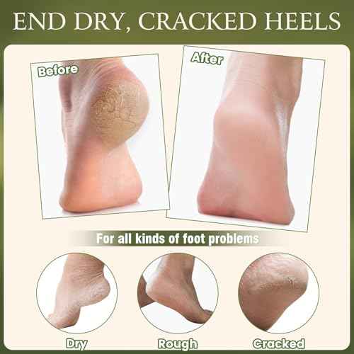 4 Pcs Cracked Heel Repair Set ?Comes with 2 Repair Sticks & 2 Foot Care Socks, Rose & Jojoba Oil Heel Balm for Dry Cracked Feet, No-Mess Applicator, Travel-Friendly