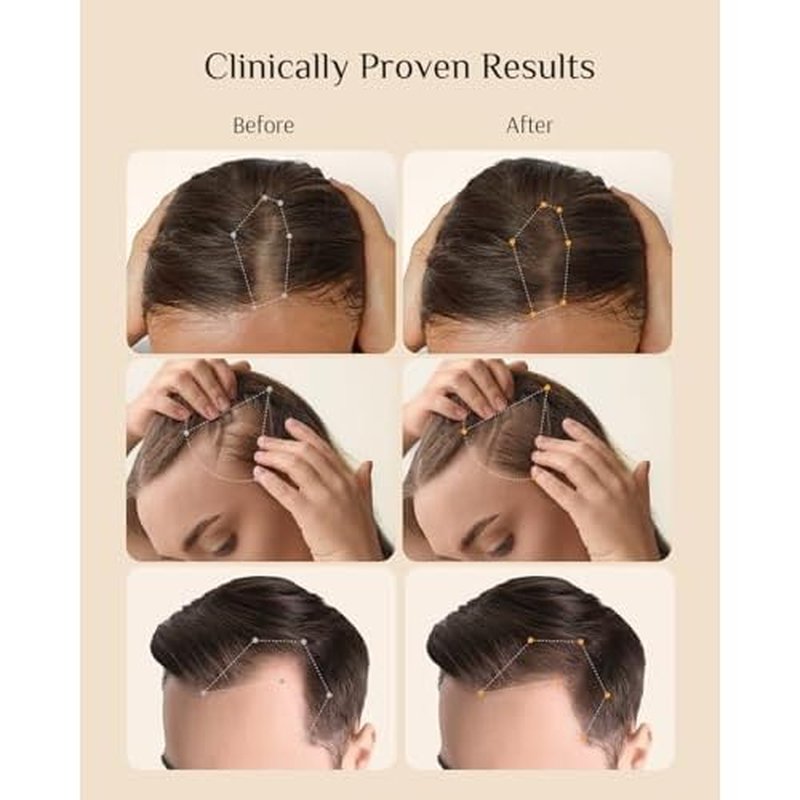 DR ZERO 3% Redensyl Hair Growth Serum for Women, Hair Scalp Serum Spray for Hair Loss and Regrowth, Clinically Tested for Hair Thinning Therapy and Scalp Care, Japanese Hair Treatment, 60ml