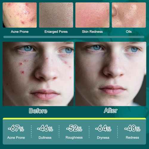 Skin Care Set,Acne Treatment for Face Skin Care Sets & Kits,Tea Tree Essential Oil Facial Skincare Gift Set with Cleanser,Toner,Serum,Gel, Acne Treatment Kit Cream Skin Care for Teens 10-12 Girls Boys