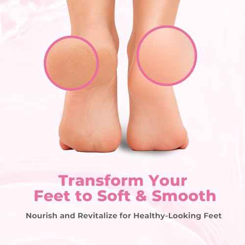 Foot Callus Remover with Foot File, Extra Strength Callus Remover Gel with Brush Head, Professional Dead Skin Removal for Feet, 8oz