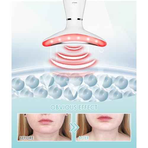 7 Color Neck Face Massager - Facial Massager Tool for Skin Care at Home, Vibrating Face Massager with Thermals, Galvanic Machines White